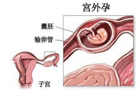上海做供卵试管婴儿哪家医院最好？最新上海排名前十试管医院名单