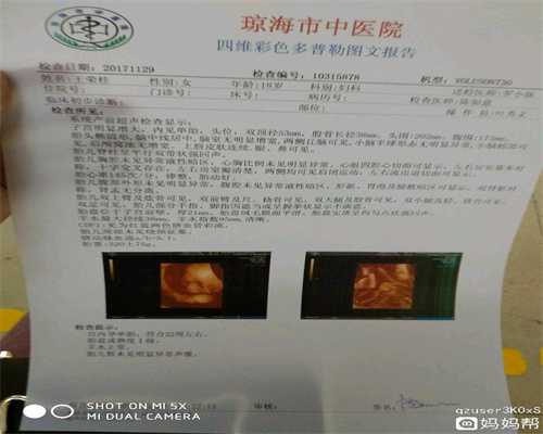 上海代孕-上海代孕市场价-上海借卵代孕多少钱