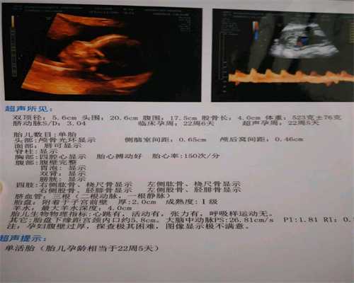 上海助孕-上海合法代生小孩-上海需要捐卵供卵代