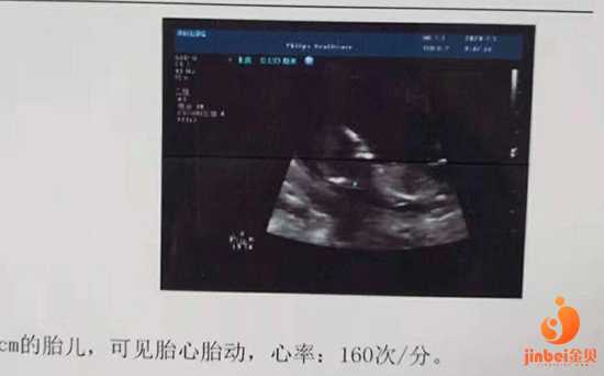 上海长海医院可以供卵吗,【上海长征医院供卵】分享我备孕路上输卵管造影的